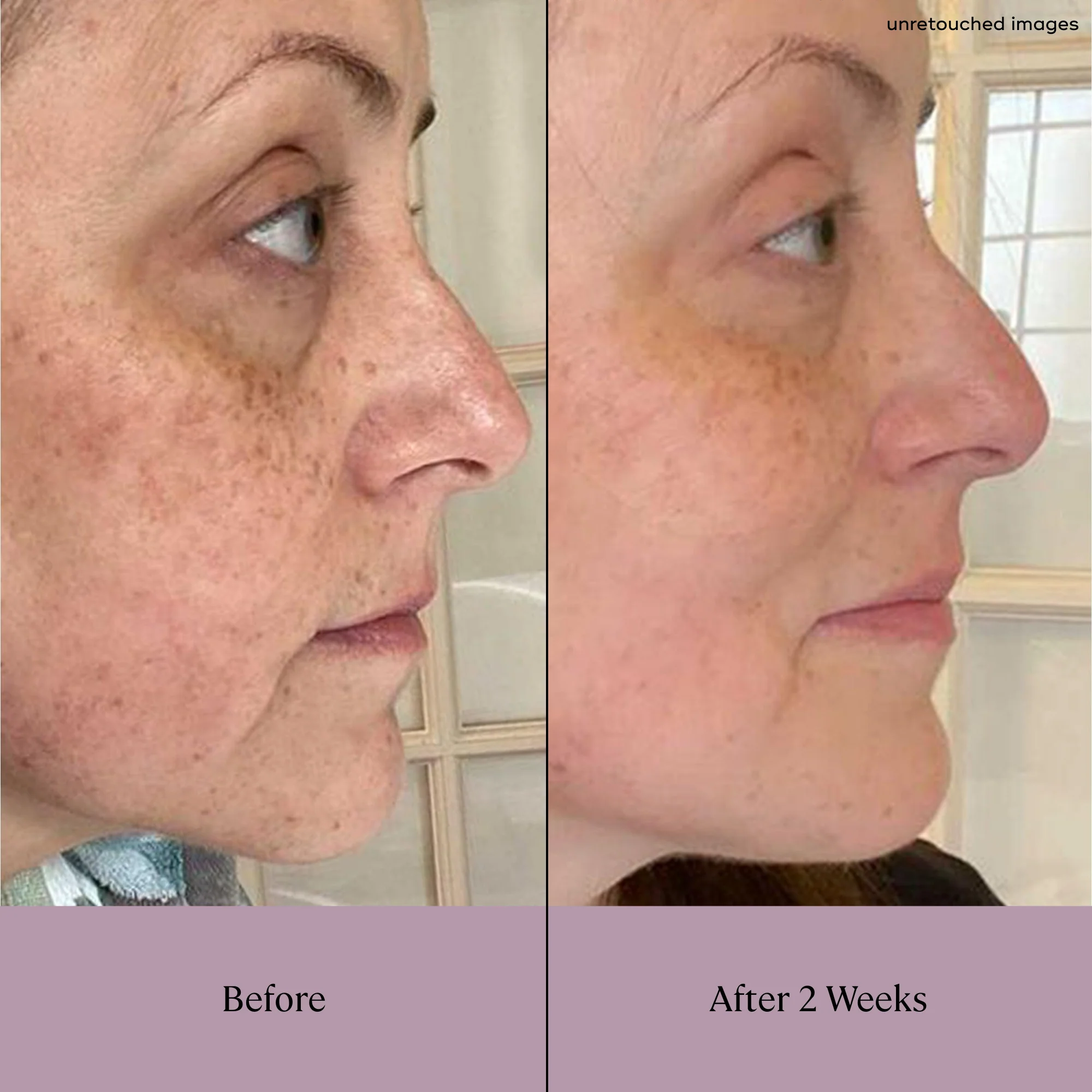 DAYTIME Brightening Serum - Image 5