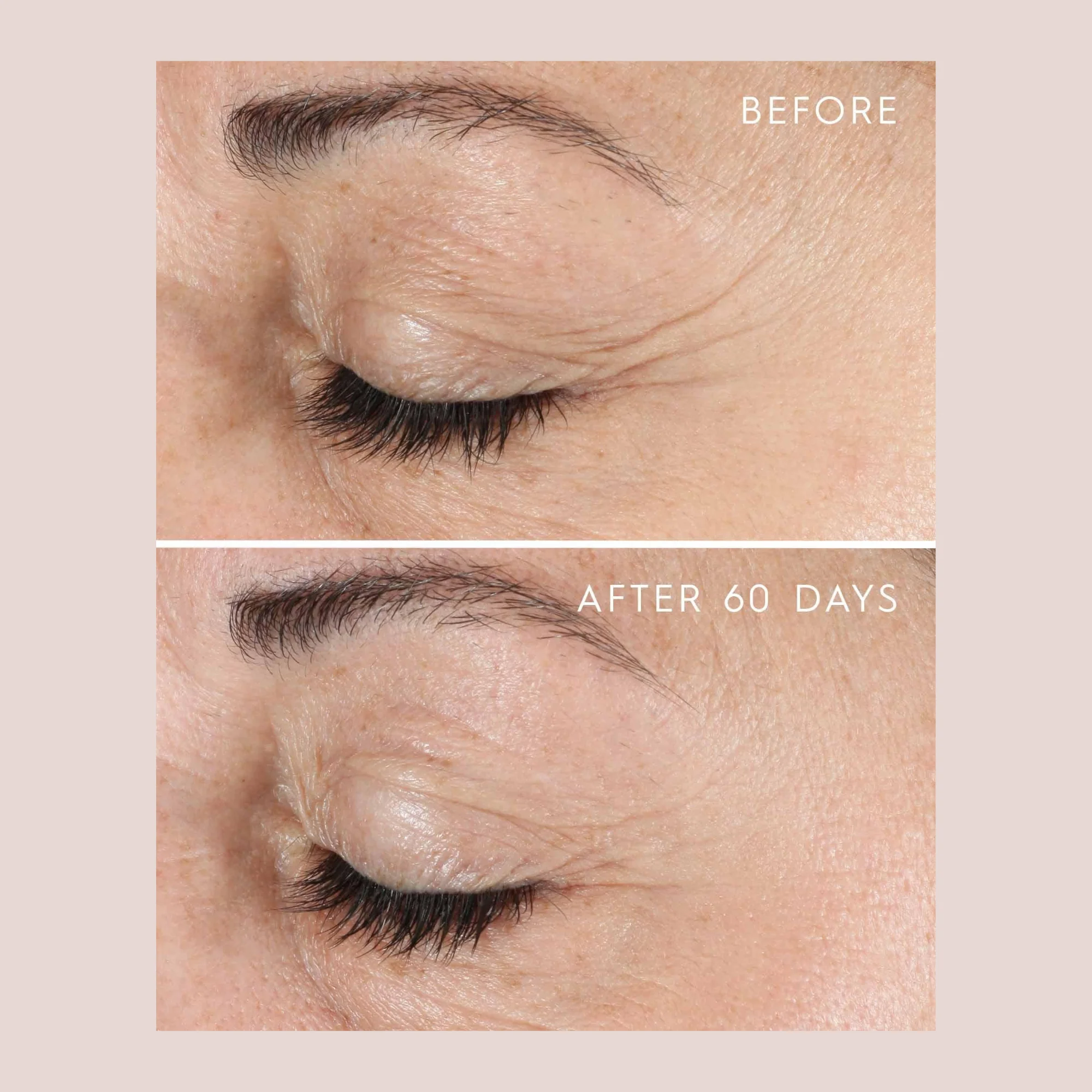 YOUTHFUL Essential Eye Concentrate - Image 4