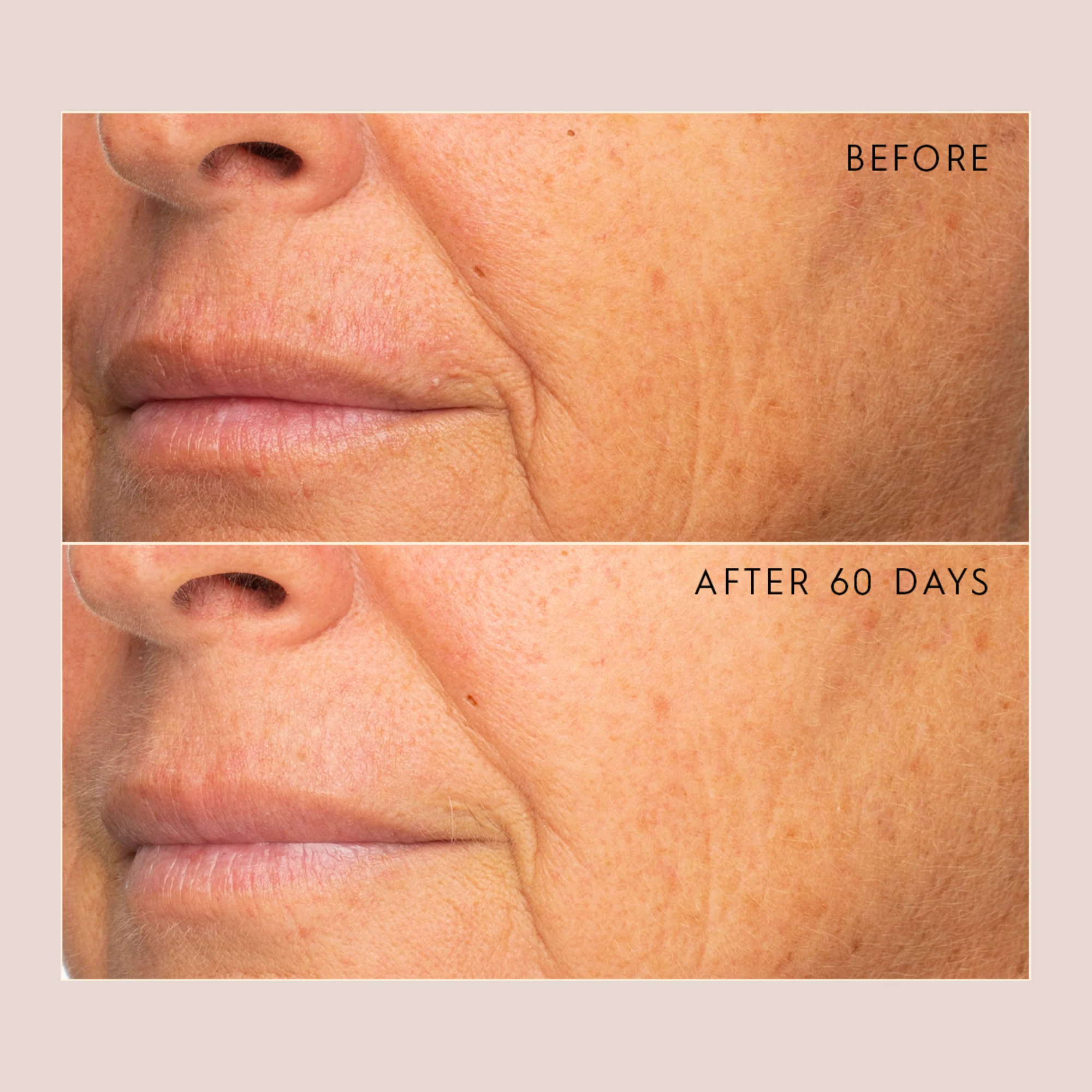 YOUTHFUL Quattro Peptide Face & Eye Serum - Image 3